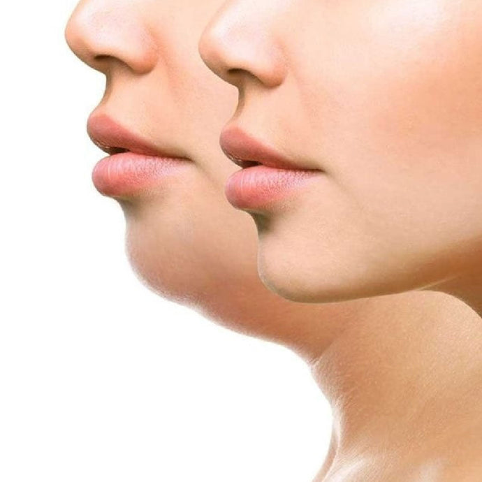 Lipolysis treatment
