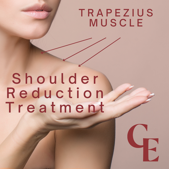 Shoulder Contouring with trapezius Botox injections